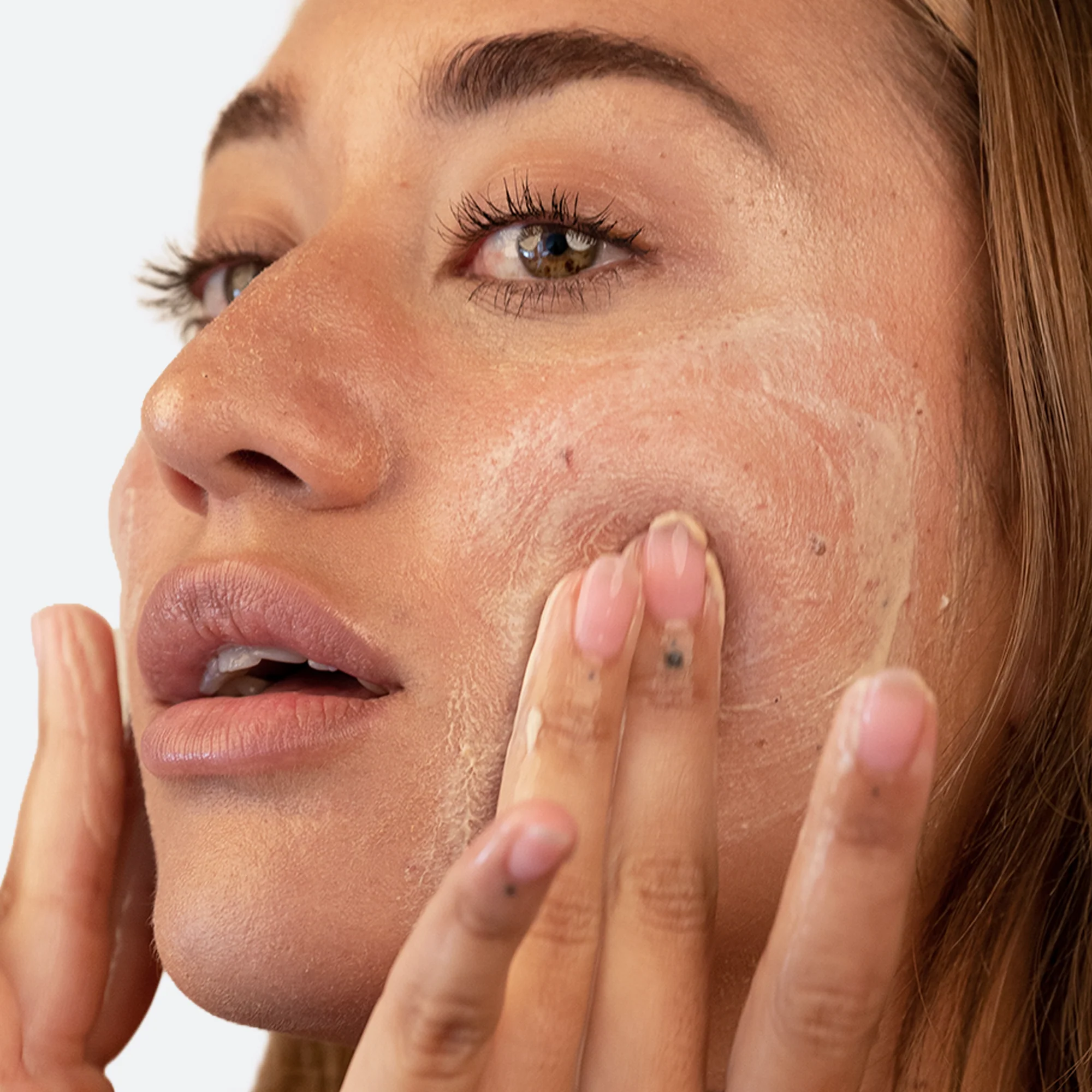 Vitamin C Microdermabrasion - Image 4